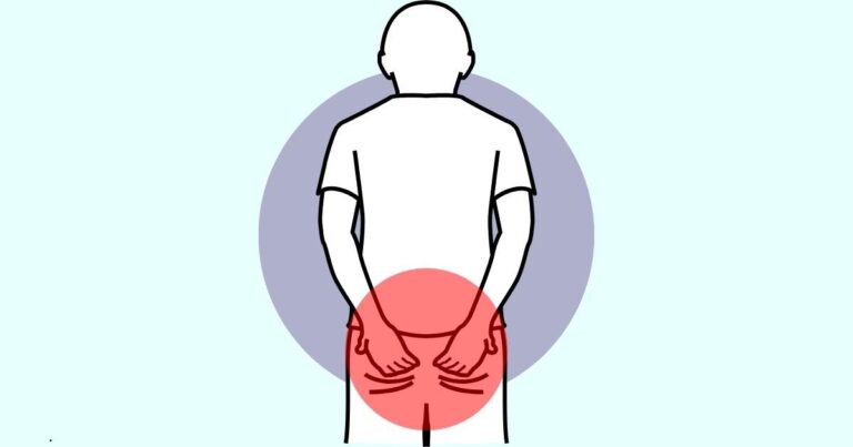 rectal pain rectal pain