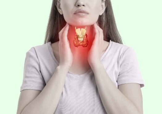 hyperthyroidism