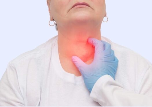hypothyroidism