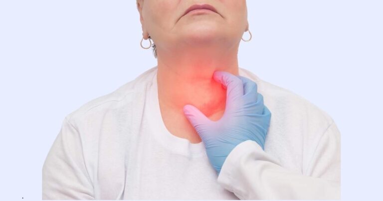 hypothyroidism hypothyroidism